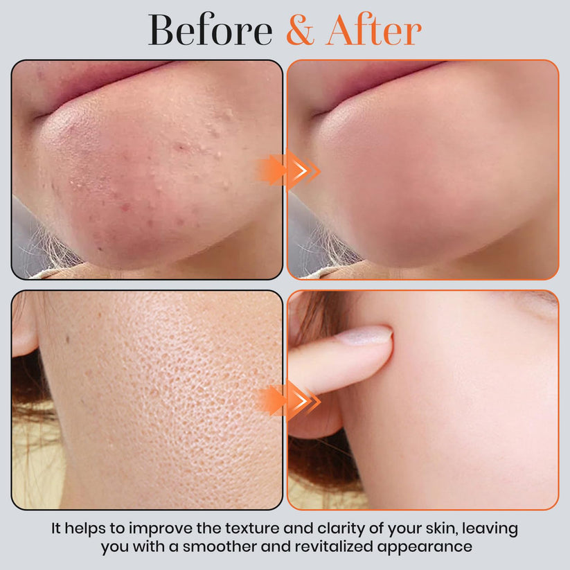Orange enzyme exfoliating gel for rough and dull-looking body areas